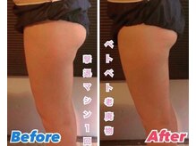 デール(R:DeeL)/ヒップもスッキリ