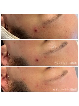 エクラ(eclat)/クリスティーナ