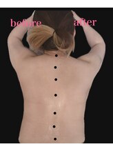 サロン アイリス(salon iRiS)/即実感！背中施術1回