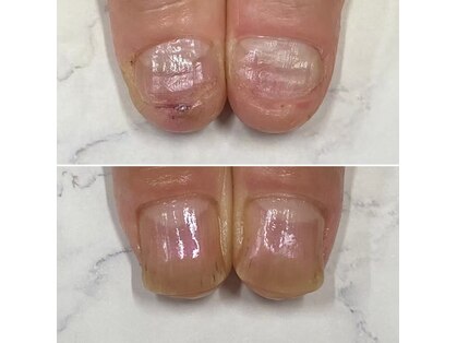 ネイルズ アヴァンティ(Nails Avanti)の写真