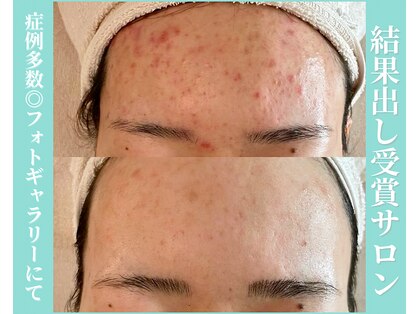 リスト(Rist TOTAL BEAUTY)の写真