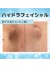 【黒ずみザラザラ毛穴】幹細胞ハイドラ毛穴洗浄！毛穴の引き締めまで◎90分