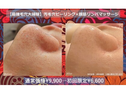 美方の写真