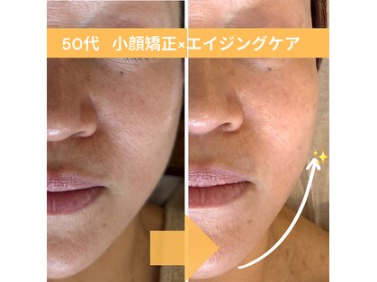 アンスルータ(ansluta.)の写真