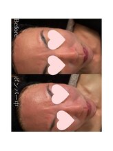 サロン ド ベルメール(Salon de Belle mer)/小顔美筋マッサージ/小顔/リンパ