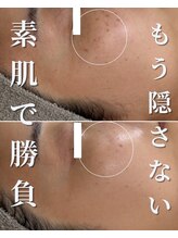 セリー(Celie)/お客様症例