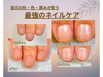ナユネイル(na_yu.nail)の写真