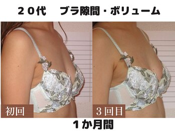 バストサロン メルベイユ(Merveile)/ふっくら、ブラ隙間が埋まる