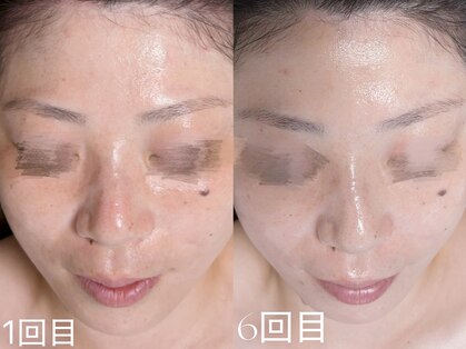 ウィハナ(wehana)の写真