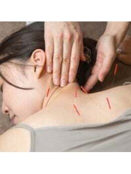 【女性専用完全個室】ひまわり鍼灸治療院 肩こり/腰痛/姿勢改善/美容鍼の写真/《鍼灸×整体》姿勢や根本改善に向けてコツコツベースアップ!お体にあう施術とアドバイスをいたします♪