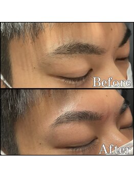 眉毛男子 新宿店/眉毛【 before / after 】