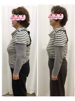 ヨサパーク ラリマー(YOSA PARK Larimar)/ビフォーアフター60代