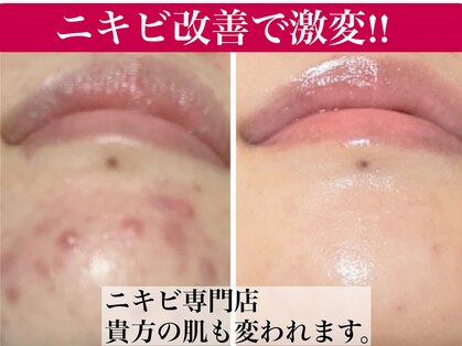 ルナティアラ(LUNAティアラ)の写真