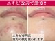 ルナティアラ(LUNAティアラ)の写真