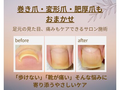 ナユネイル(na_yu.nail)の写真