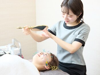 ソエルテ/美容鍼でお肌のトーンUP◎