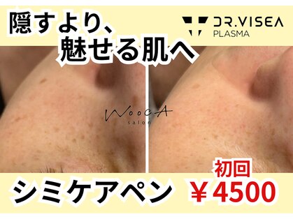 サロン ウーカ(salon WOOCA)の写真