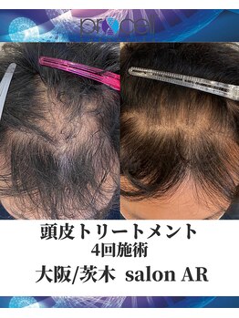 メンズサロンアール(AR)/プロセルセラピーズ