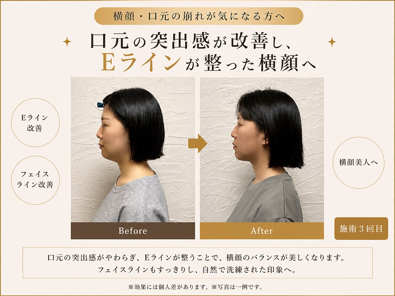 整音(totonone)｜ホットペッパービューティー