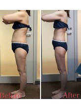 ダイエット サポート(DIET SUPPORT)/短期＆グロッティ　施術結果