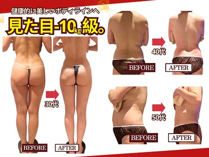 セルライト専門店【癒しゼロの熱血エステ】FEMBE錦糸町店【7/1　NEW OPEN（予定）】の写真