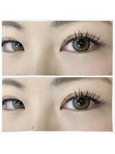 ソラーレ(Solare)/フラットラッシュ140本