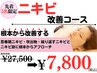 6月限定5名まで!【美容鍼灸】ニキビケアコース¥27,500→¥7,800　※初回限定