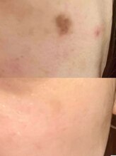 ラエッセ 恵比寿(LAESSE)/毛穴・美白専門店 LAESSE 恵比寿