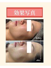 ナーズ(NAZ)/美白コース