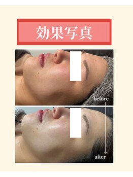 ナーズ(NAZ)/美白コース