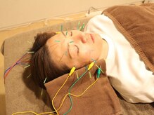 サルース(Salus)の雰囲気（美容鍼でお肌のお悩みを改善【小顔/むくみ改善/美肌/しみケア】）