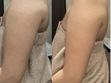 ジジベレッザ 芦屋店(jiji belleza)/気になるところだけスリムに