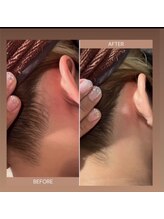 インフィニティ ビューティサロン 姫路店(INFINITY beautysalon)/脱毛