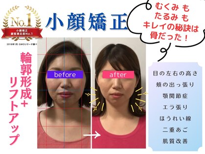 プレフェランス(Preference)の写真