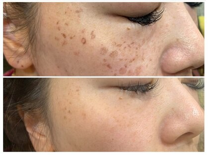 ポルトボーテ(Porte Beaute)の写真