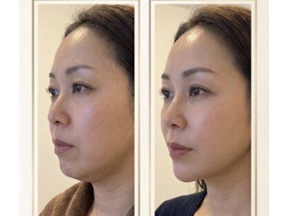 メルティーズ 東京 麻布十番(MELTY's)の写真