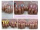 シュシュ(chouchou)の写真
