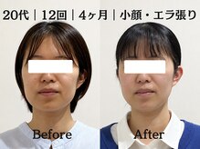 マルウル(maluulu)の雰囲気(頑固なエラ張りやむくみがスッキリ解消、驚くほど小顔に変身)