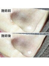 美鼻ラボ 押上 曳舟/横顔も実は見られている！？