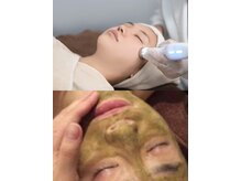 エスポワ