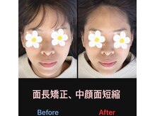 美容矯正サロン レレポノ(LELEPONO)/