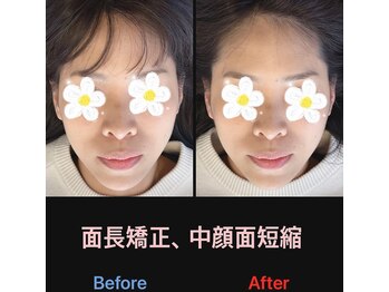 美容矯正サロン レレポノ(LELEPONO)/