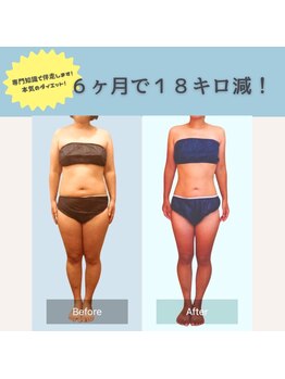 エルバード/6ヶ月で18Kg減！