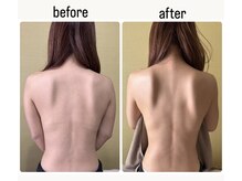 シャルム(Charme)/アロマトリートメント