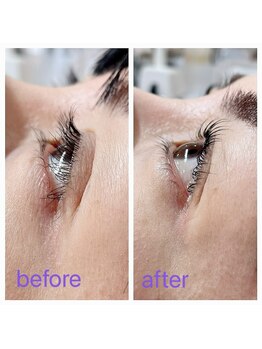 ハピネス(HAPPINESS)/before→after