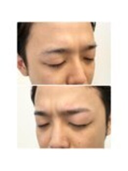 アイビー 神保町店(i.b)/眉【before⇒after】19