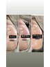 人気No. 1【産毛/角質/顔ダニ/毛穴】艶肌Wax +ヒト幹¥12,000→¥9,800