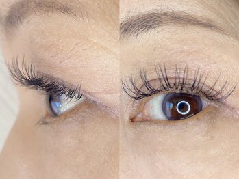 シャイン(shine)/ナチュラル