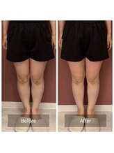 ウテナ(UTENA)/空ルート×整体