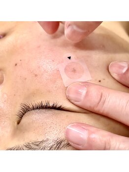 ラウレア(Laule'a)/美容フィルムシート(シミケア後)